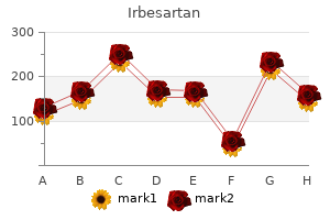 cheap irbesartan 300mg amex