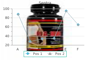 purchase 480 mg septra mastercard