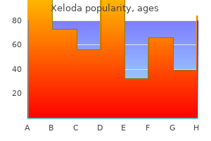 purchase xeloda with a visa