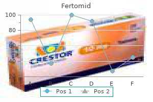 safe 50mg fertomid