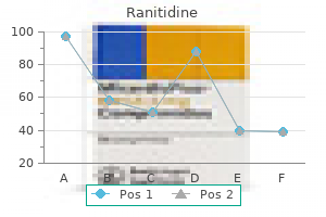 discount 150mg ranitidine mastercard