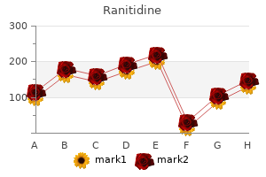 buy ranitidine 300mg amex