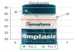 purchase 35mg alendronate fast delivery