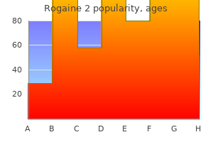 60ml rogaine 2 overnight delivery